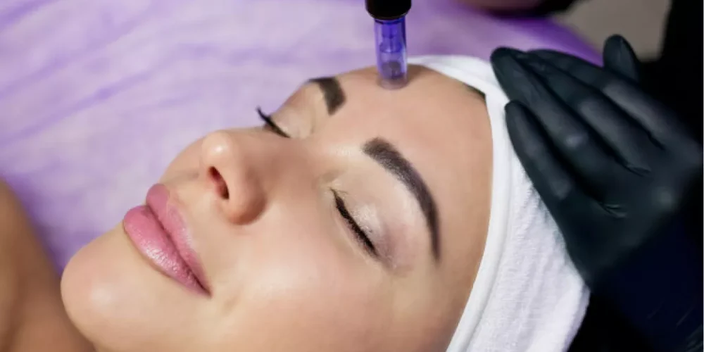 Microneedling-post-03
